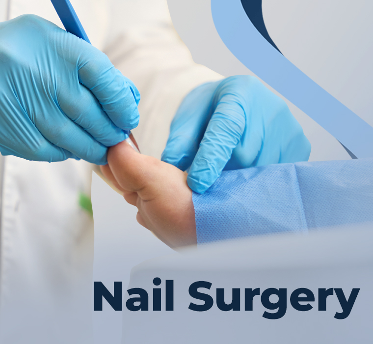 Nail Surgery